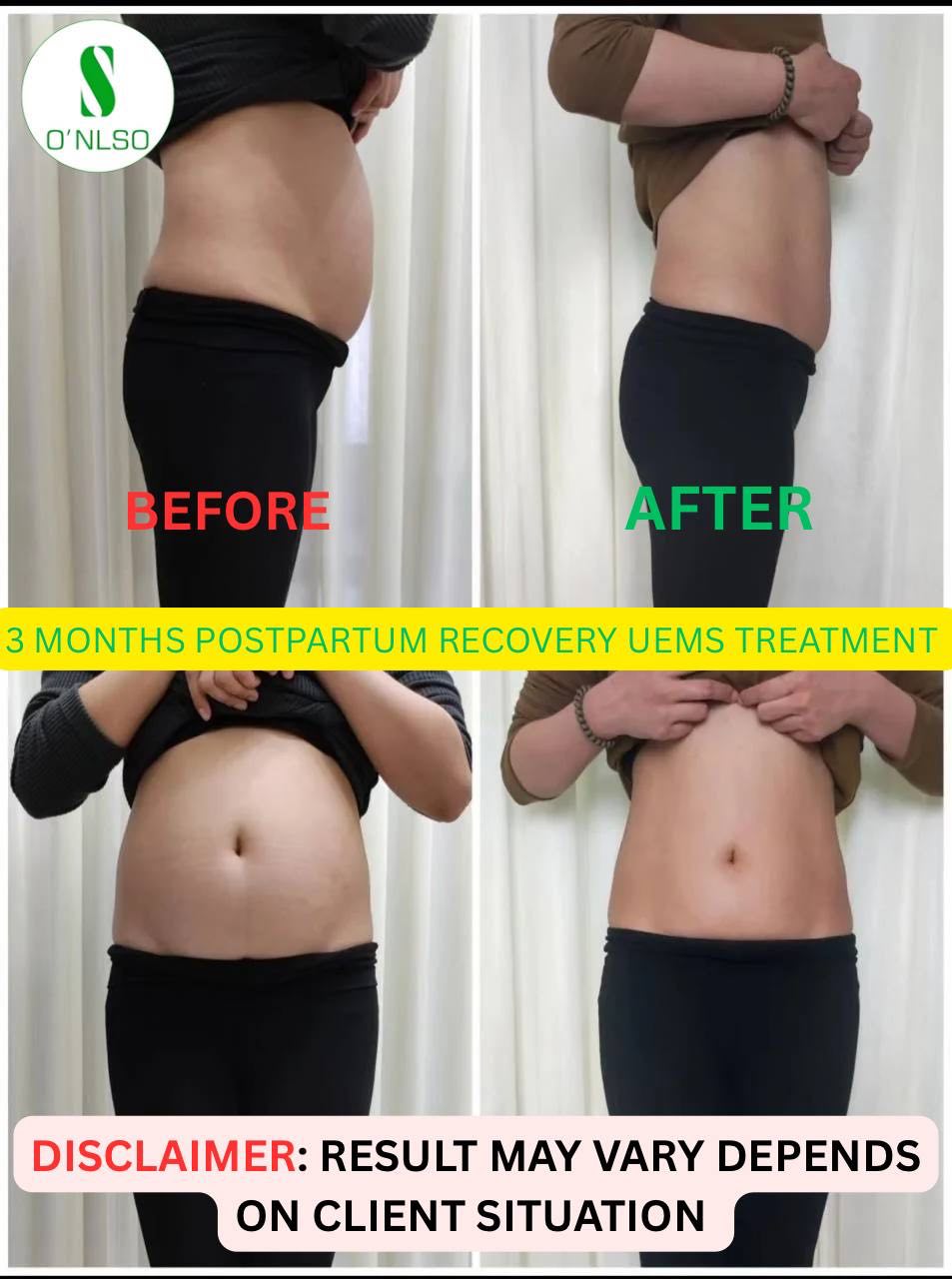 Postpartum Recovery in Metro Manila: Real Client Photos & Visit Guide